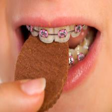 خوراکی های مفید برای ارتودنسی
