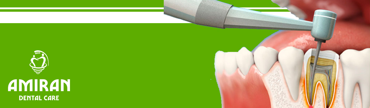  درمان ریشه دندان